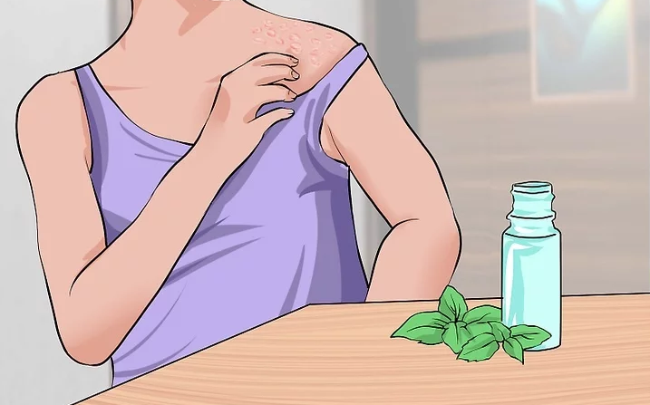 Cách điều trị hắc lào hiệu quả ngay tại nhà